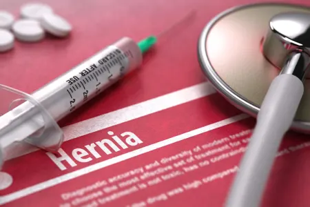covidien hernia mesh lawsuits bellwether trials start february 2026