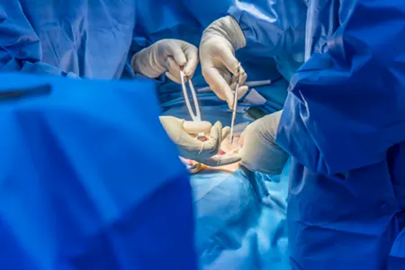 hernia operation using the covidien hernia mesh